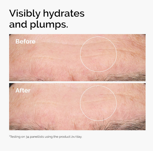 The Ordinary Ácido Hialurónico 2% + B5 – Suero Hidratante con Ceramidas para una Piel más Suave y Rellena, 30 ml