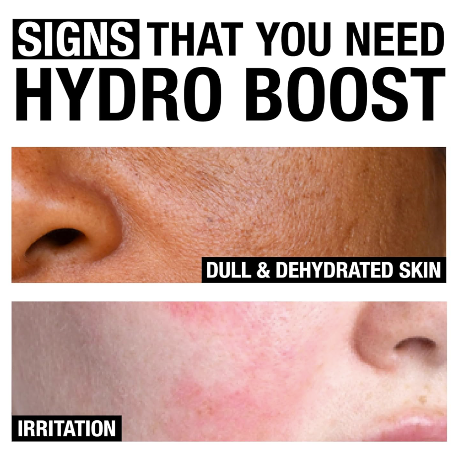 Neutrogena Hydro Boost Gel Cleanser – Limpiador Facial con Ácido Hialurónico, 230 ml